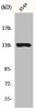 Western Blot analysis of A549 cells using JAK1 Polyclonal Antibody