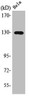 Western Blot analysis of HuvEc cells using LOK Polyclonal Antibody