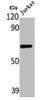 Western Blot analysis of Jurkat cells using LRG1 Polyclonal Antibody