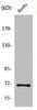 Western Blot analysis of HuvEc cells using Menin Polyclonal Antibody