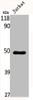 Western Blot analysis of Jurkat cells using MNT Polyclonal Antibody