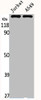 Western Blot analysis of Jurkat A549 cells using MRP7 Polyclonal Antibody