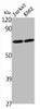 Western Blot analysis of Jurkat K562 cells using NFκB-p65 Polyclonal Antibody