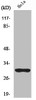 Western Blot analysis of Hela cells using NQO1 Polyclonal Antibody