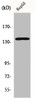 Western Blot analysis of HeLa cells using p140Cap Polyclonal Antibody