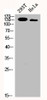 Western Blot analysis of 293T HELA cells using p140Cap Polyclonal Antibody