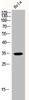 Western Blot analysis of HELA cells using p35 Polyclonal Antibody