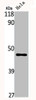 Western Blot analysis of HELA cells using PAI-3 Polyclonal Antibody Western Blot analysis of HELA cells using PAI-3 Polyclonal Antibody
