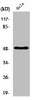 Western Blot analysis of Hela cells using PDK1 Polyclonal Antibody