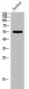 Western Blot analysis of Jurkat cells using PFK-2 liv Polyclonal Antibody