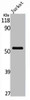 Western Blot analysis of Jurkat cells using PFK-2 liv Polyclonal Antibody