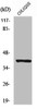 Western Blot analysis of Jurkat cells using PKAα/β cat Polyclonal Antibody