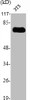 Western Blot analysis of NIH-3T3 cells using PKR Polyclonal Antibody