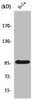 Western Blot analysis of HepG2 cells using Plakophilin 2 Polyclonal Antibody