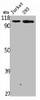 Western Blot analysis of Jurakt 293 cells using Plakophilin 2 Polyclonal Antibody