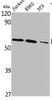 Western Blot analysis of Jurkat K562 NIH-3T3 cells using PLK-5 Polyclonal Antibody