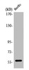 Western Blot analysis of HuvEc cells using PPAR-γ Polyclonal Antibody