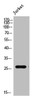 Western Blot analysis of Jurkat cells using PRX1 Polyclonal Antibody