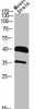 Western Blot analysis of Jurkat NIH-3T3 cells using Rag A/B Polyclonal Antibody