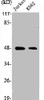 Western Blot analysis of Jurkat K562 cells using SSB Polyclonal Antibody