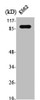 Western Blot analysis of K562 cells using Stat5a Polyclonal Antibody