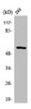 Western Blot analysis of 293 cells using MMP-3 Polyclonal Antibody