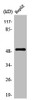 Western Blot analysis of HepG2 cells using TPH1 Polyclonal Antibody