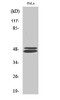 Western Blot analysis of Hela cells using VASP Polyclonal Antibody diluted at 1:500. Secondary antibody was diluted at 1:20000