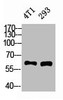 Western Blot analysis of 4T1 293 cells using XIAP Polyclonal Antibody