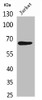 Western Blot analysis of Jurkat cells using NFκB-p65 Polyclonal Antibody