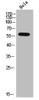 Western Blot analysis of HELA cells using ALS2CR13 Polyclonal Antibody