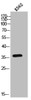 Western Blot analysis of K562 cells using AR-β3 Polyclonal Antibody