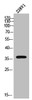 Western Blot analysis of 22RV1 cells using AR-β3 Polyclonal Antibody