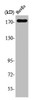 Western Blot analysis of HuvEc cells using EGFR Polyclonal Antibody