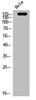 Western Blot analysis of hela cells using EGFR Polyclonal Antibody