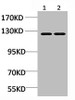 Western blot analysis of 1) Mouse Brain Tissue, 2) Rat Brain Tissue using CASR Polyclonal Antibody.