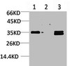 Western blot analysis of 1) Human Brain Tissue, 2) Mouse Brain Tissue, 3) Rat Brain Tissue using L-type Ca++ CP γ5 Polyclonal Antibody.