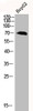 Western Blot analysis of HEPG2 using Phospho-LIMK-1 (T508) Polyclonal Antibody.