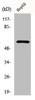 Western Blot analysis of 293 cells using Dab1 Polyclonal Antibody