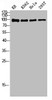 Western blot analysis of KB K562 Hela 293T lysis using NFκB-p100 antibody.