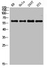 Western blot analysis of KB Hela 293T 3T3 lysis using NFκB-p65 antibody.