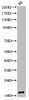 Western Blot analysis of KB cells using Acetyl-Histone H3 (K9) Polyclonal Antibody