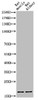 Western Blot analysis of RAT-KIDNEY RAT-MUSCLE cells using Acetyl-Histone H3 (K9) Polyclonal Antibody