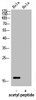 Western Blot analysis of hela using Acetyl-Histone H3 (K9) Polyclonal Antibody.