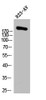 Western Blot analysis of 823-AV cells using ACCα Polyclonal Antibody