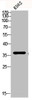 Western blot analysis of K562 lysis using p38 antibody.