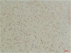 Immunohistochemical analysis of paraffin-embedded Mouse BrainTissue using GABA Transporter 1 Rabbit pAb diluted at 1:200.