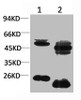 Western blot analysis of 1) Rat Brain Tissue, 2) Mouse Brain Tissue with KV1.8 Rabbit pAb diluted at 1:2, 000.