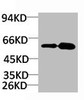 Western blot analysis of 1) Rat Brain Tissue, 2) Mouse Brain Tissue with KV11.1 Rabbit pAb diluted at 1:2, 000.