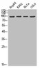 Western blot analysis of HepG2 K562 Hela Colo using ADAMTS-2 antibody.. Secondary antibody was diluted at 1:20000